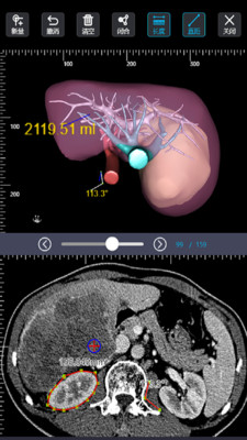 莲影(智能影像处理)